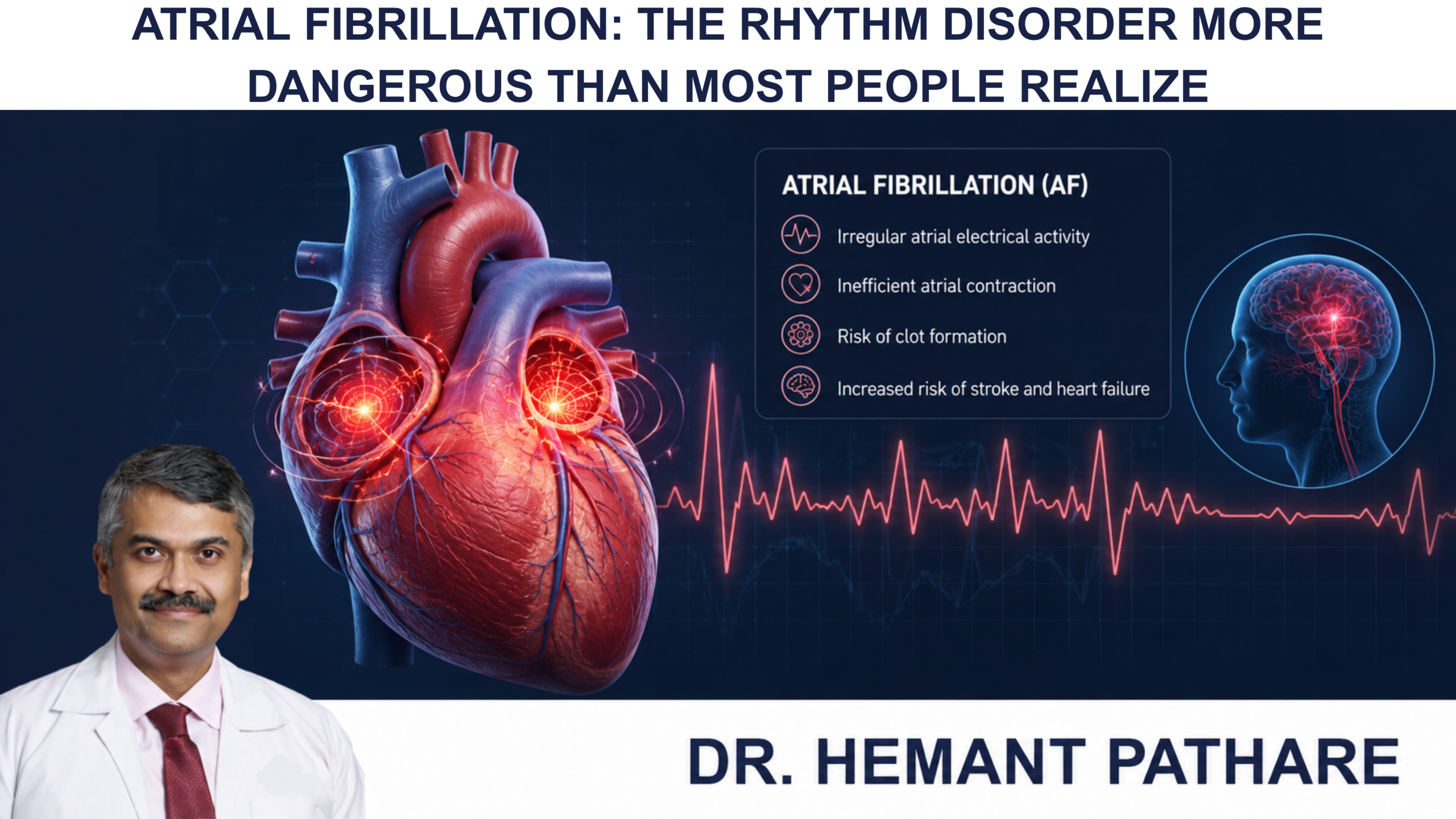 Atrial Fibrillation: The Rhythm Disorder More Dangerous Than Most People Realize