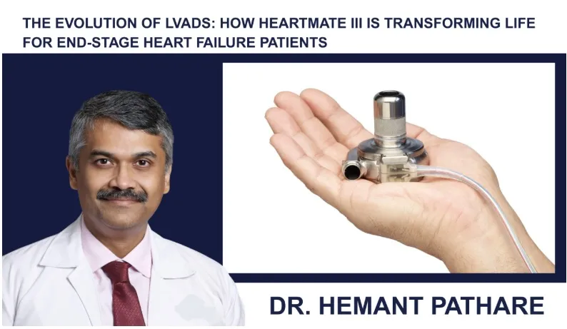 The Revolution of Heart Failure Care: Why LVADs are the Future of Life-Saving Therapy